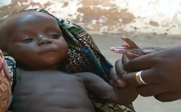 NIGER : TAUX DE MALNUTRITION ALARMANT CHEZ LES ENFANTS